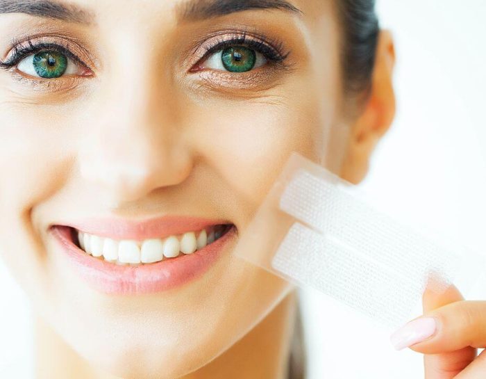 Cara Merawat Gigi Setelah Bleaching untuk Hasil yang Tahan Lama